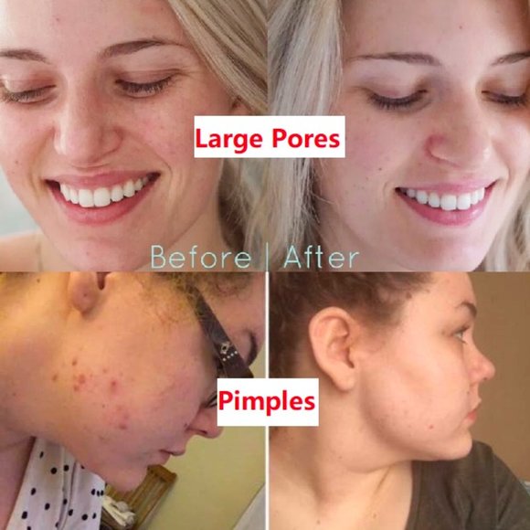 Deep Cleaning Detoxifying Facial Cleansing Clay MASK - Blackhead/oil remover - Picture 8 of 9